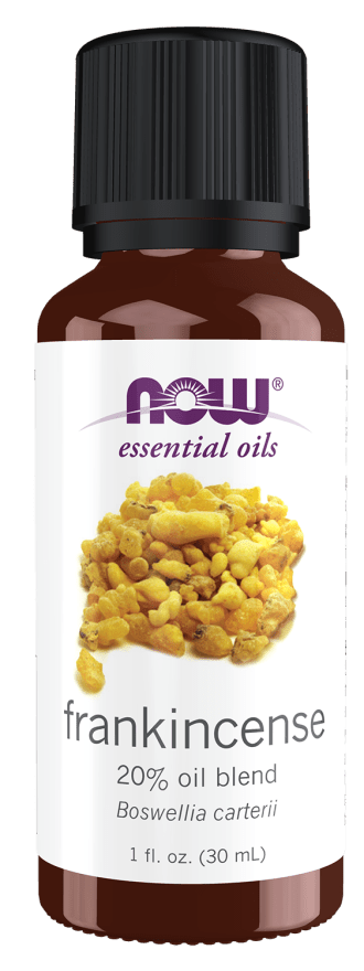 Frankincense Essential Oil, 20%